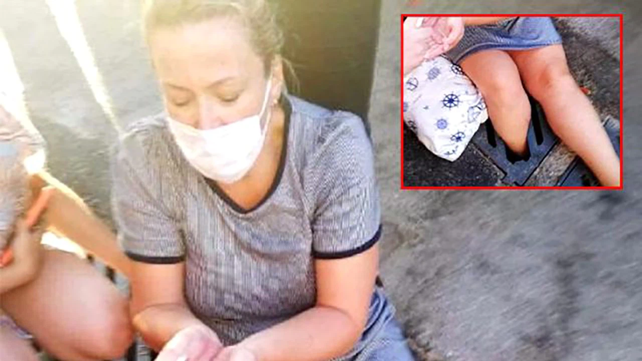 Mazgala bacağı sıkışan kadında krık tespit edildi