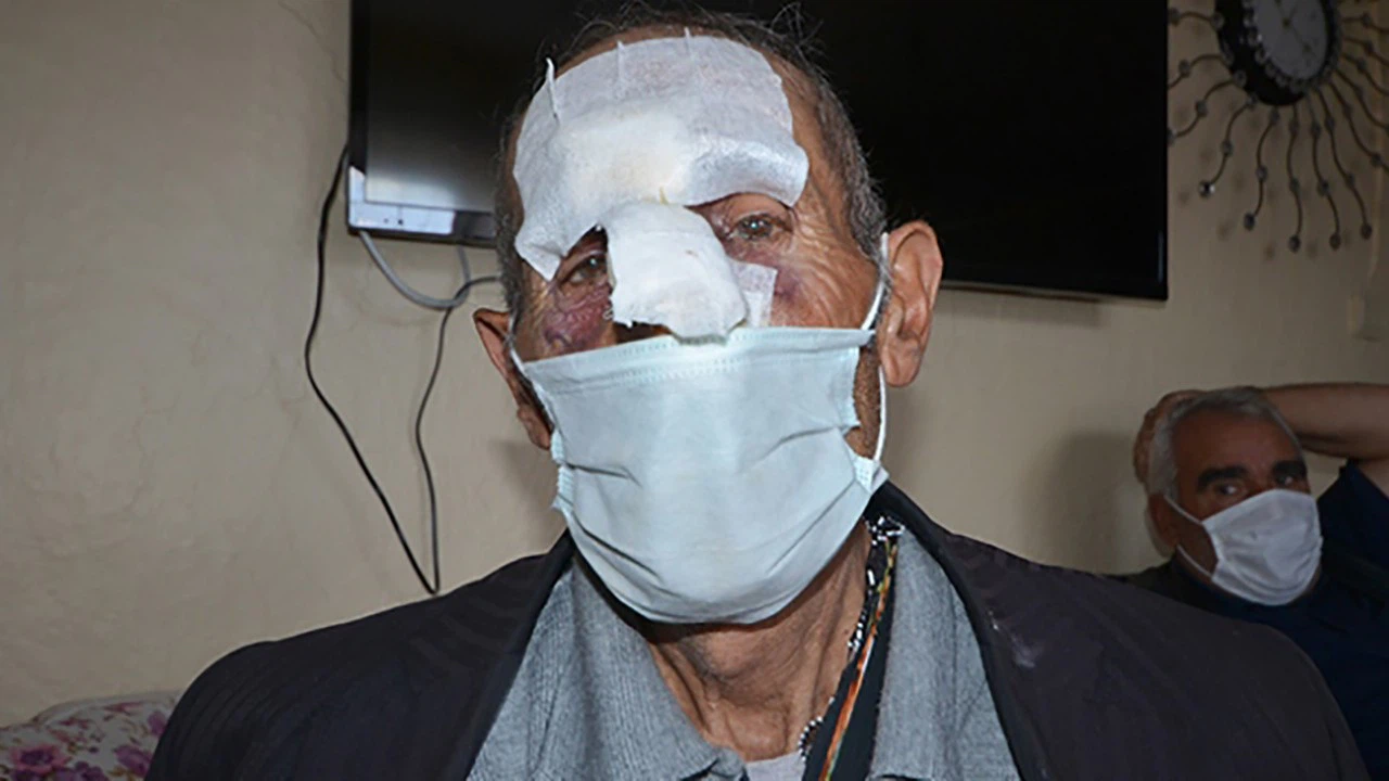 Ormanda odun toplarken ayı saldırdı