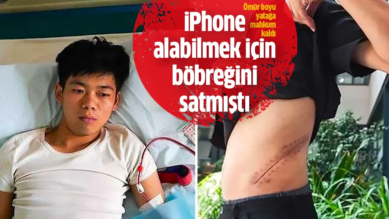 iPhone alabilmek için böbreğini satan genç, ömür boyu yatağa mahkum oldu