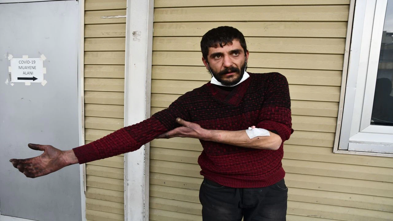 Gaziantep'te pitbull cinsi köpeğin saldırdığı kişi yaralandı