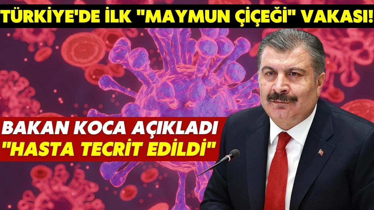 Türkiye'de ilk "maymun çiçeği" vakası tespit edildi!