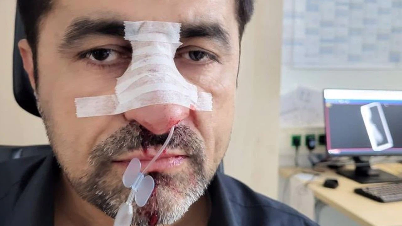 Almanya'da Türk kökenli siyasetçiye ırkçı saldırı