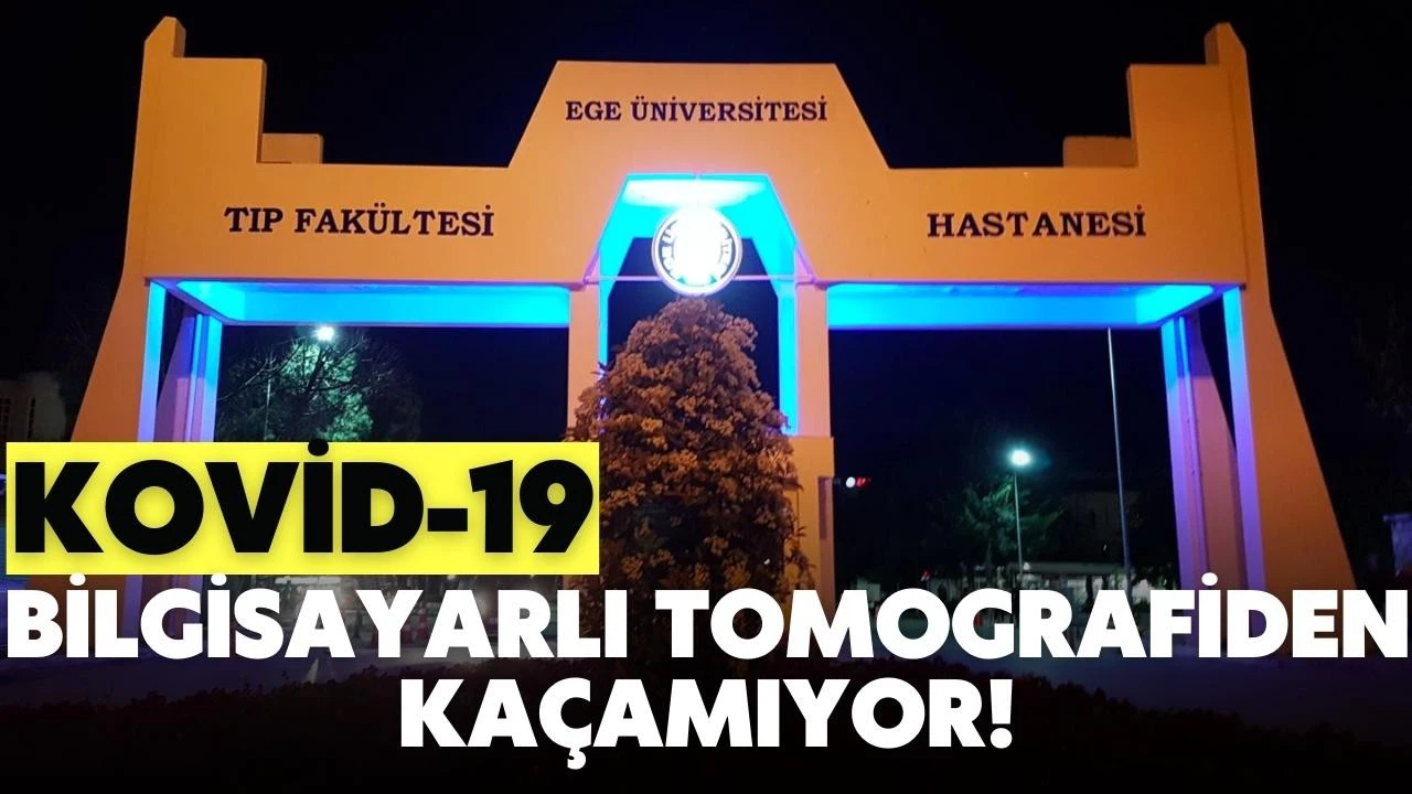 Kovid-19 artık bilgisayarlı tomografiden kaçamıyor