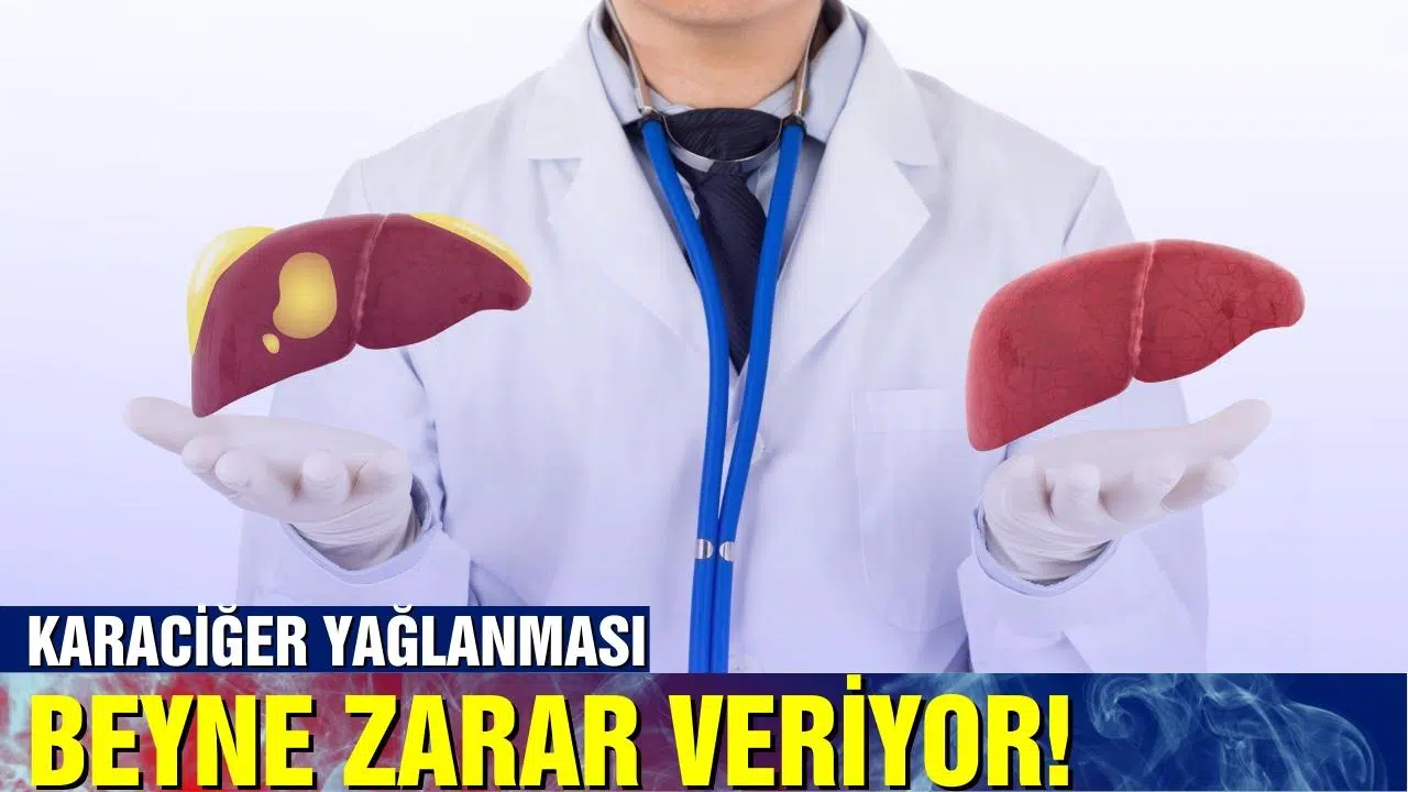 Karaciğer yağlanması, beyne zarar veriyor!