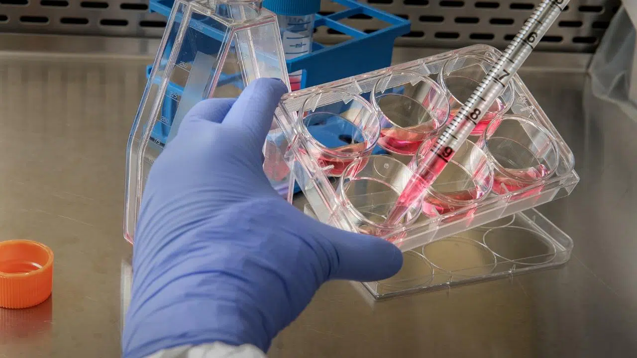 Hollanda'da deli dana vakası!