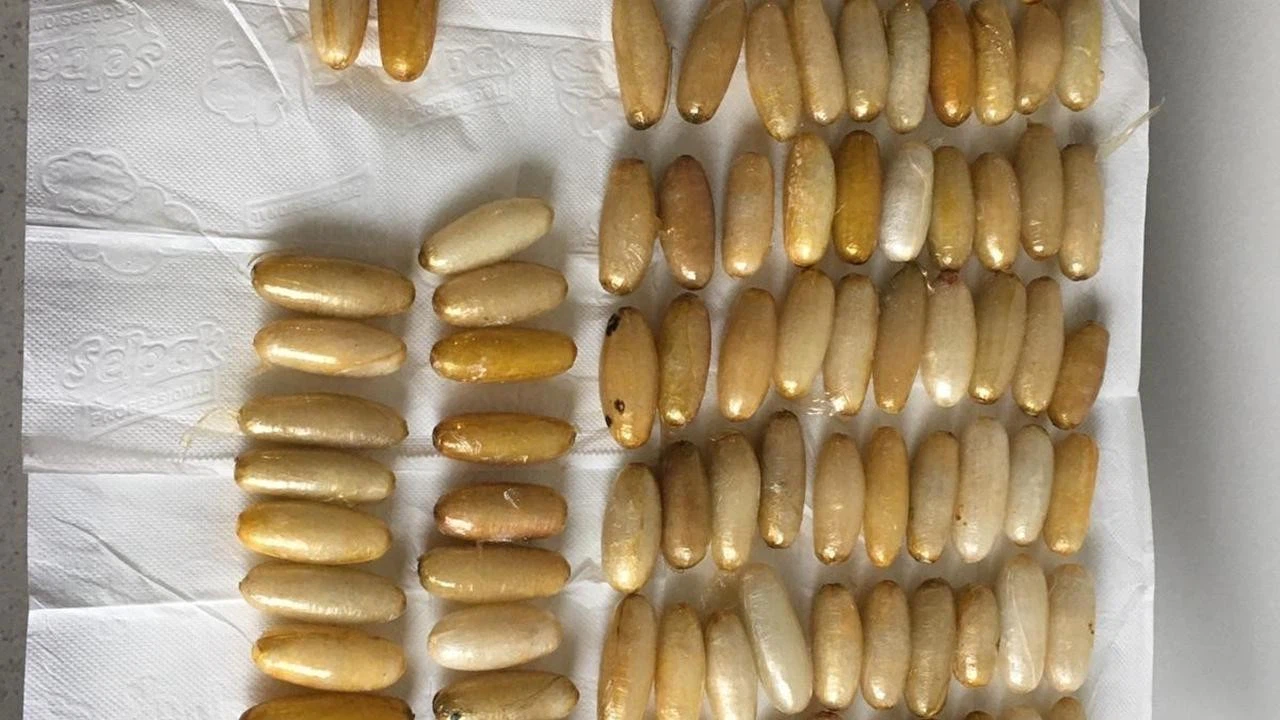 Yabancı uyruklu bir kişinin midesinden 300 gram uyuşturucu çıktı!