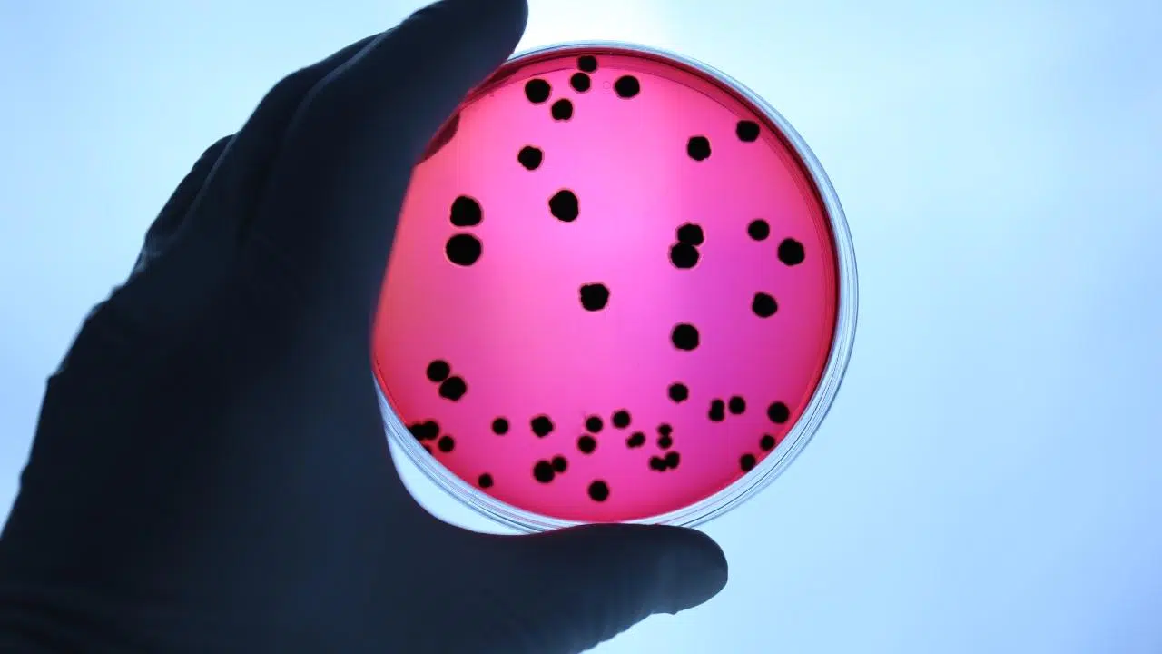 Polonya'da lejyonella bakterisi can alıyor: 7 ölü!