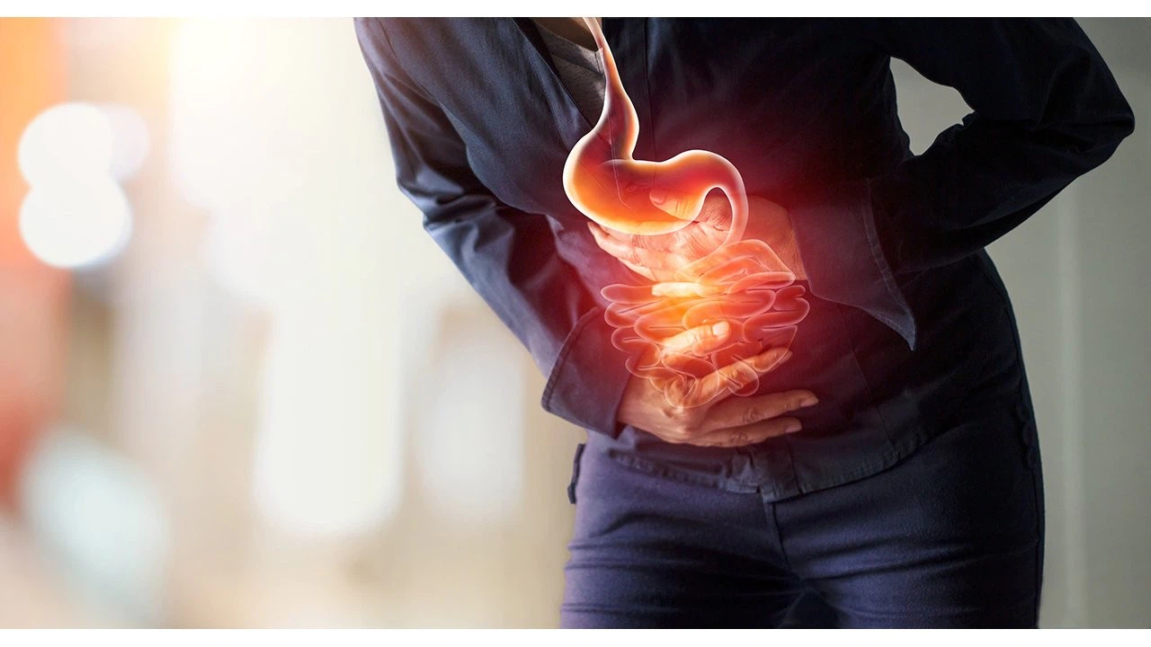 Reflü - Ramazanda reflü - Reflü tedavisi ve nasıl tedavi edilir