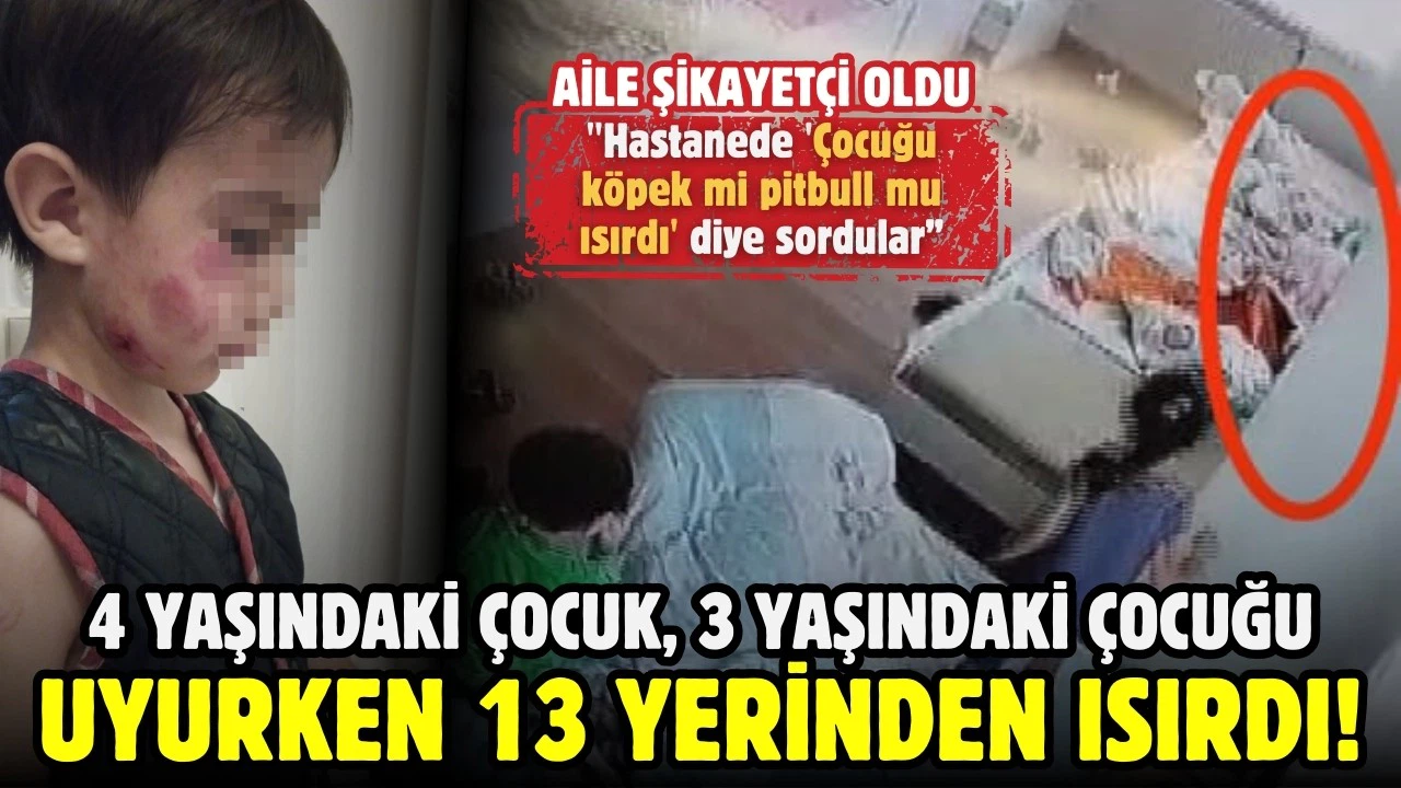 4 yaşındaki çocuk 3 yaşındaki çocuğu uyurken 13 yerinden ısırdı!