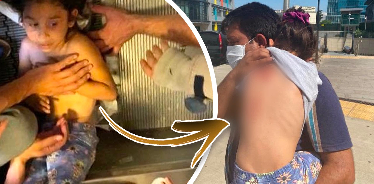 Küçük kızın son hali yürek burktu!