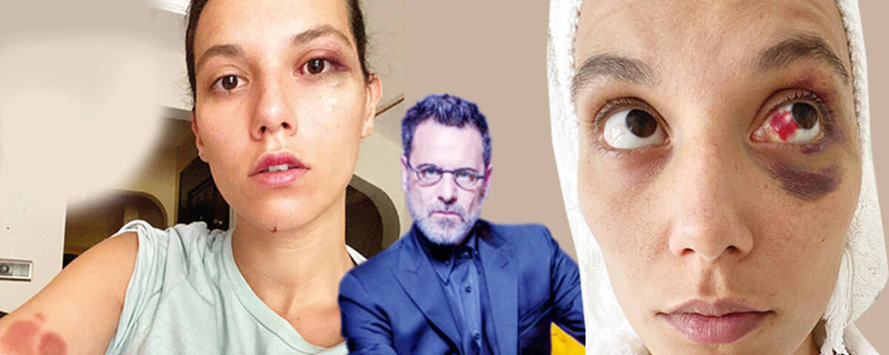 Ozan Güven'e bir şok daha!