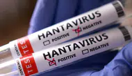 Sağlık Bakanlığı: “Hantavirüs testleri negatif çıktı”