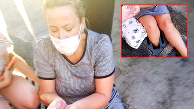 Mazgala bacağı sıkışan kadında krık tespit edildi