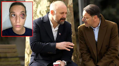 Ergenç, sevgilisini döven Güven'i savundu: Olaydan alnının akıyla çıkacak