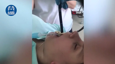 Rusya'da uyuyan kadının ağzından giren yılan ameliyatla çıkarıldı