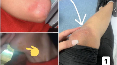 Fransa’da Türklere yönelik polis şiddeti