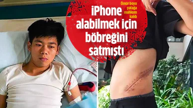 iPhone alabilmek için böbreğini satan genç, ömür boyu yatağa mahkum oldu