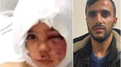 Tasmasız pitbull kurbanı Asiye'nin babası işten kovuldu