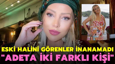 Gülşah Saraçoğlu'nun eski hali hayranlarını şoke etti