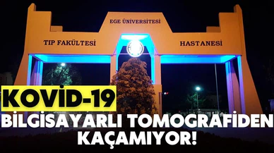 Kovid-19 artık bilgisayarlı tomografiden kaçamıyor