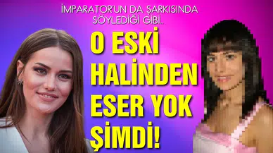 Fahriye Evcen'in estetiksiz hali şaşırttı!