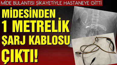 Midesinden 1 metrelik şarj kablosu ve saç tokası çıktı!