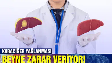 Karaciğer yağlanması, beyne zarar veriyor!