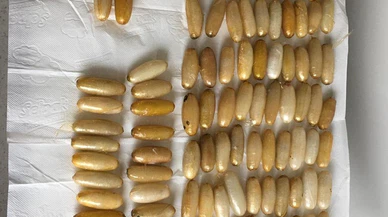 Yabancı uyruklu bir kişinin midesinden 300 gram uyuşturucu çıktı!