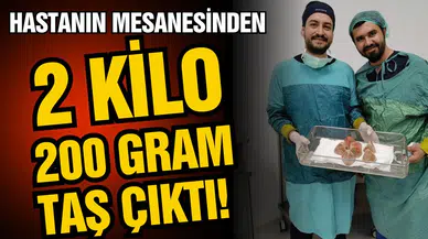 Hastanın mesanesinden 2 kilo 200 gram taş çıktı