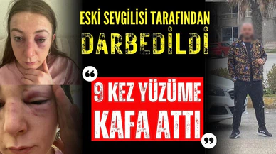 Eski sevgilisi tarafından darbedilen Sibel: 9 defa yüzüme kafa attı