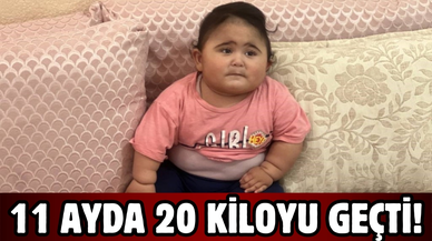 Şanlıurfa’da 11 aylık bebek 20 kiloyu geçti!