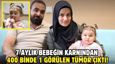 7 aylık bebeğin karnından 400 binde 1 görülen tümör çıktı!