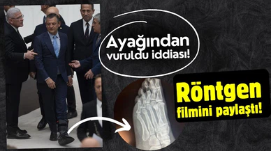 Özgür Özel'den "vuruldu" iddialarına röntgenli yanıt!