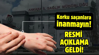 Ankara'da maymun çiçeği görüldü iddialarına yalanlama!