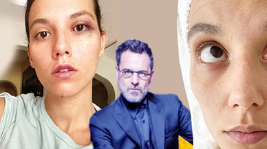 Ozan Güven'e bir şok daha!