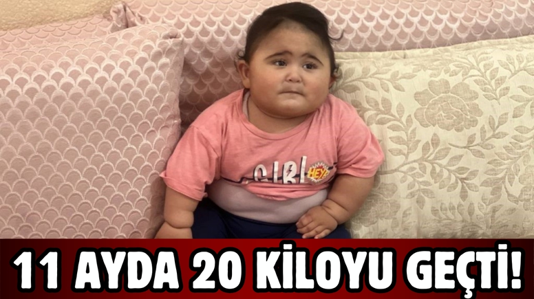 Şanlıurfa’da 11 aylık bebek 20 kiloyu geçti!