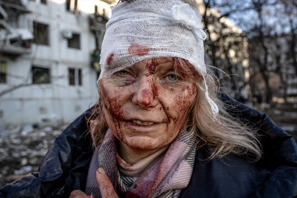 Rusya-Ukrayna savaşının birinci yılında unutulmaz kareler! 4