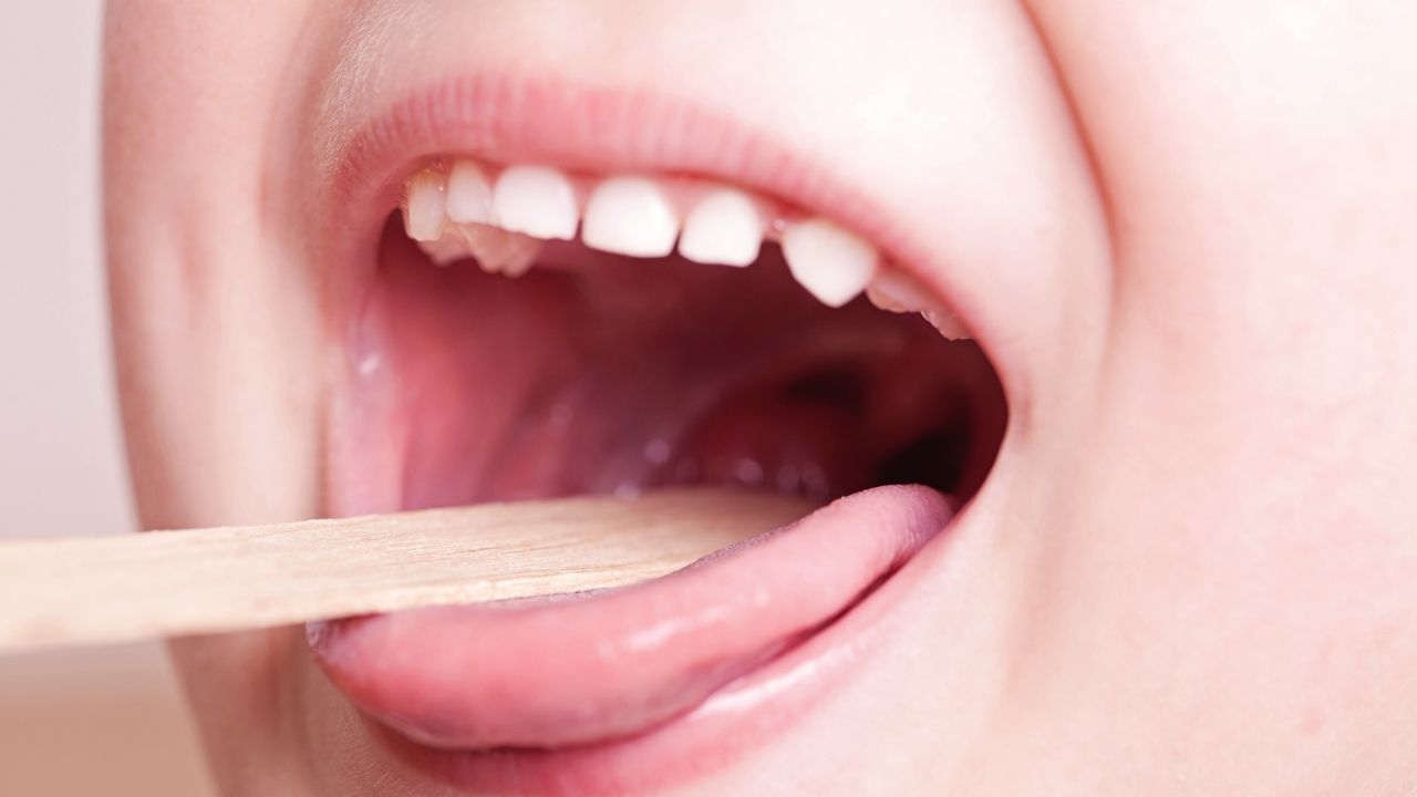 Japonya'da yeni salgın: Strep A virüsü 3