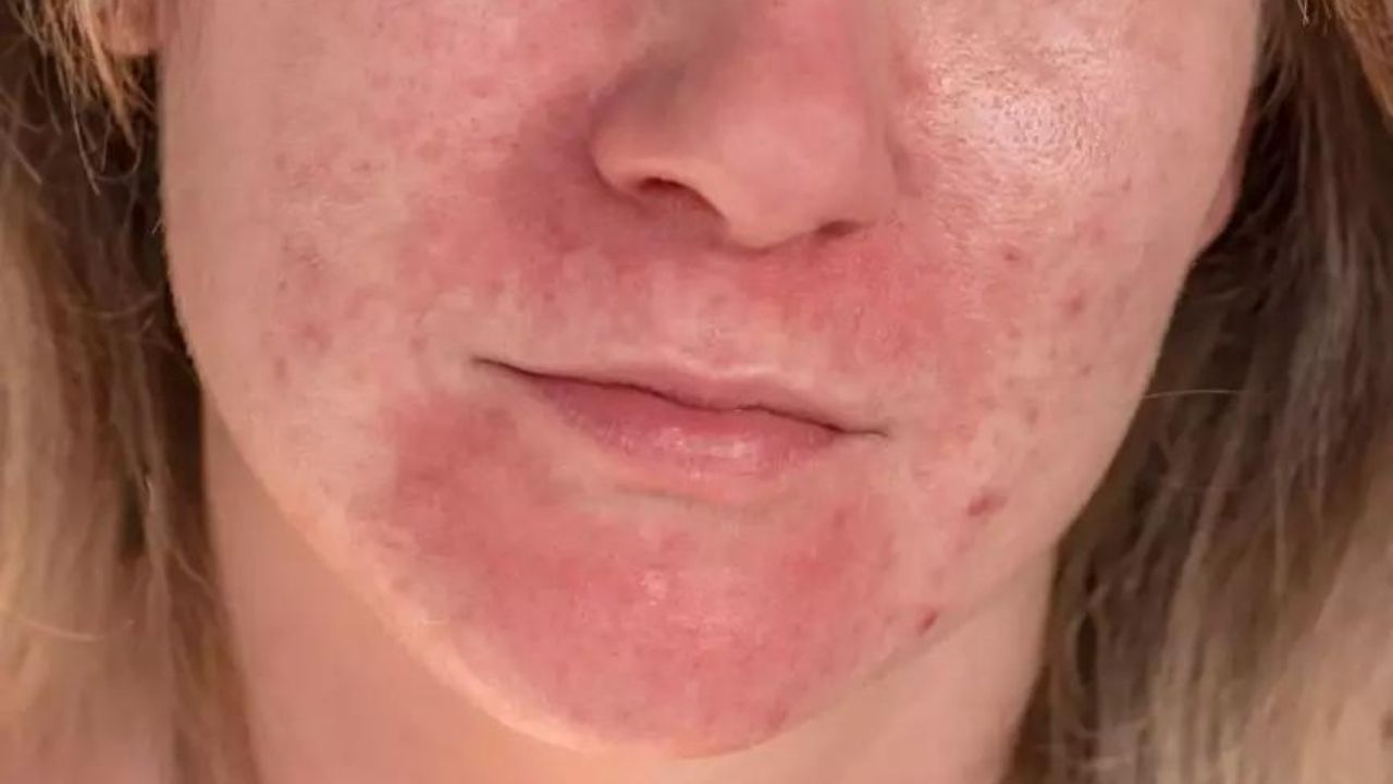 İkinci el makyaj ürünlerindeki büyük tehlikeye dikkat! 6