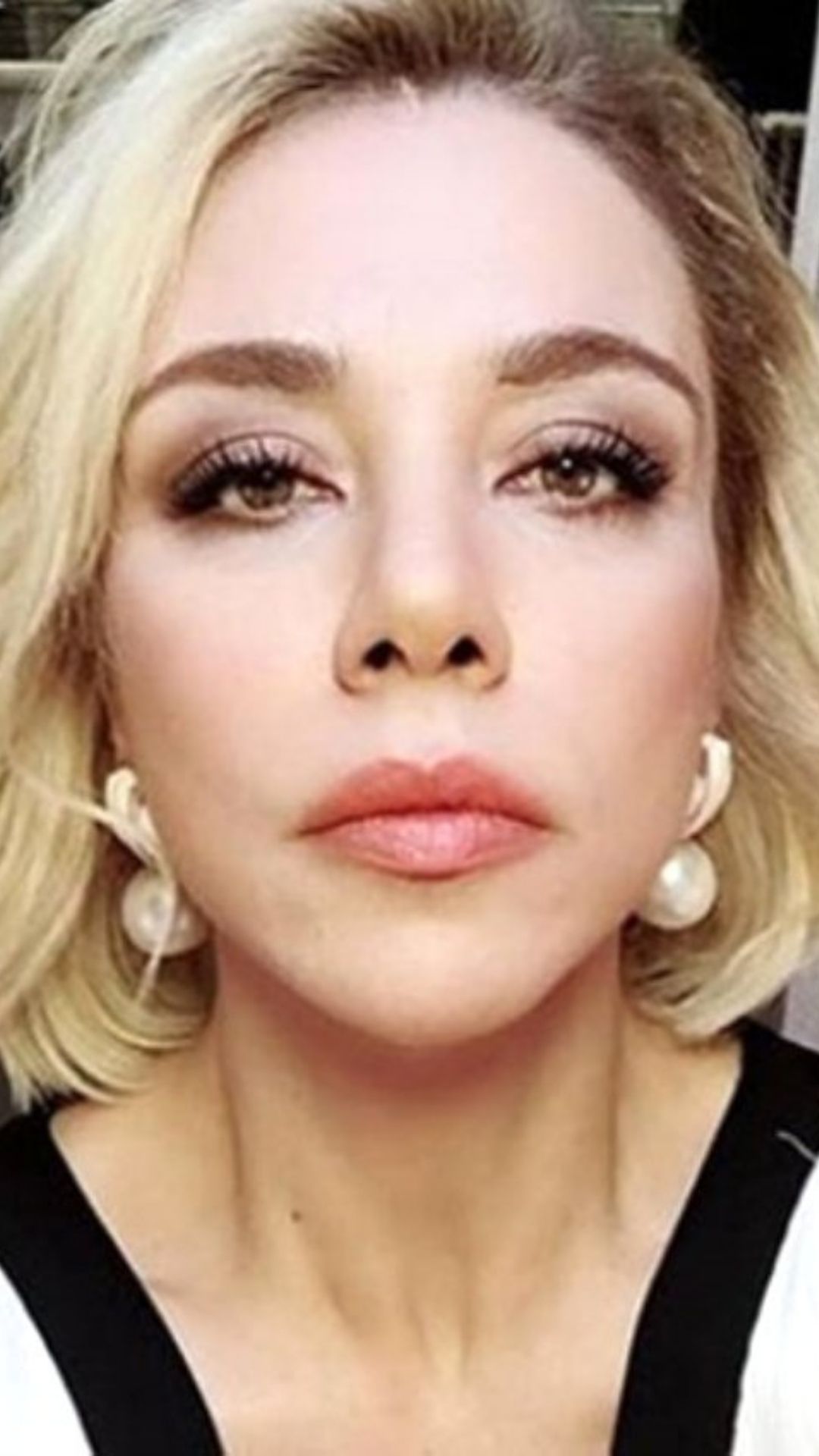 Türk dizilerinin sevilen ismi iğne ipliğe döndü! 5