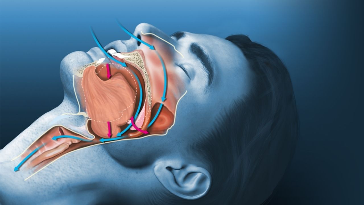 Uyku apnesi olanlar ehliyet alamayacak mı? DMM açıkladı 3