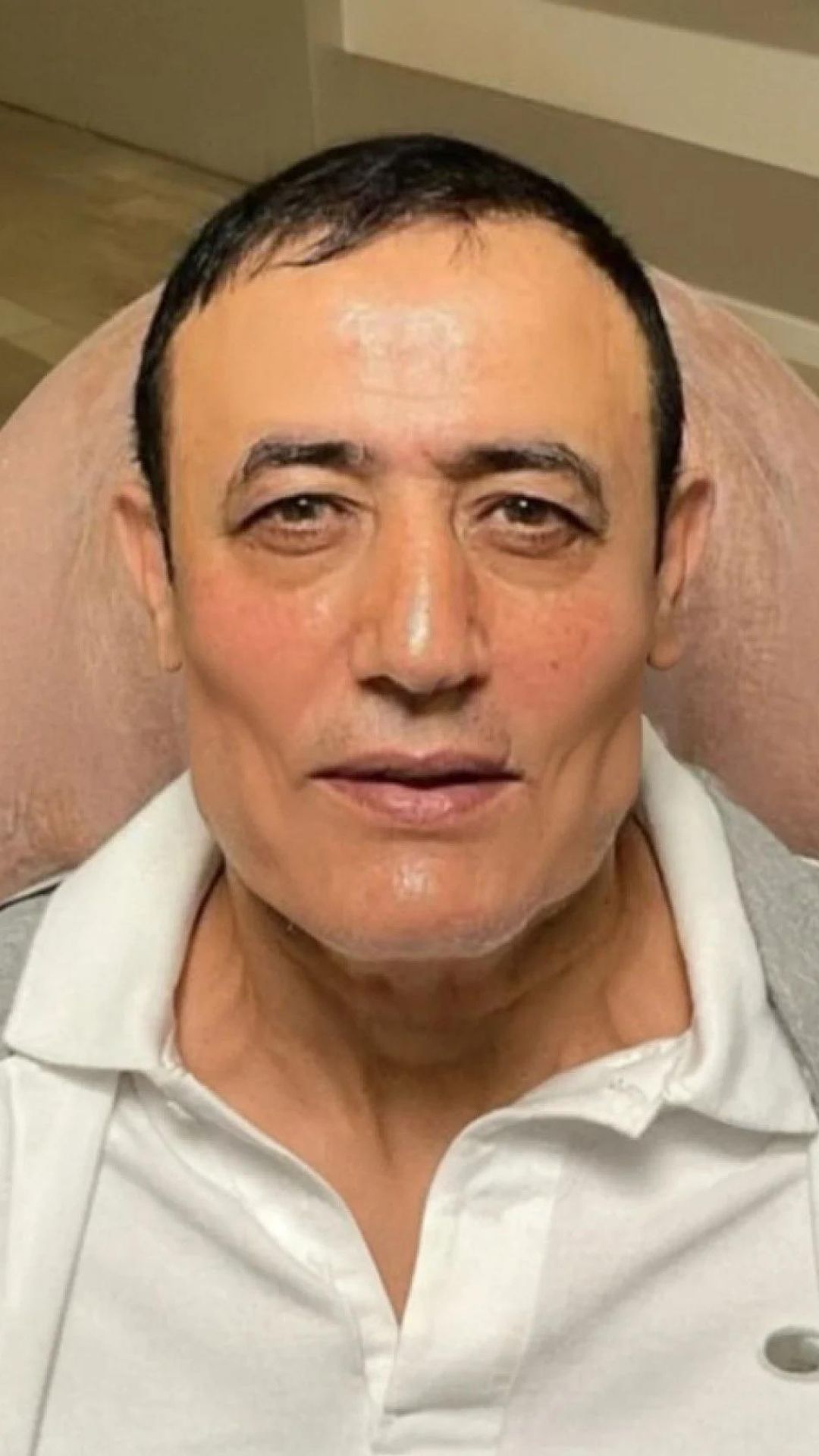 Estetikliler kervanına ünlü şarkıcı Mahmut Tuncer de katıldı! Tuncer, 10 yaş gençleşti 2