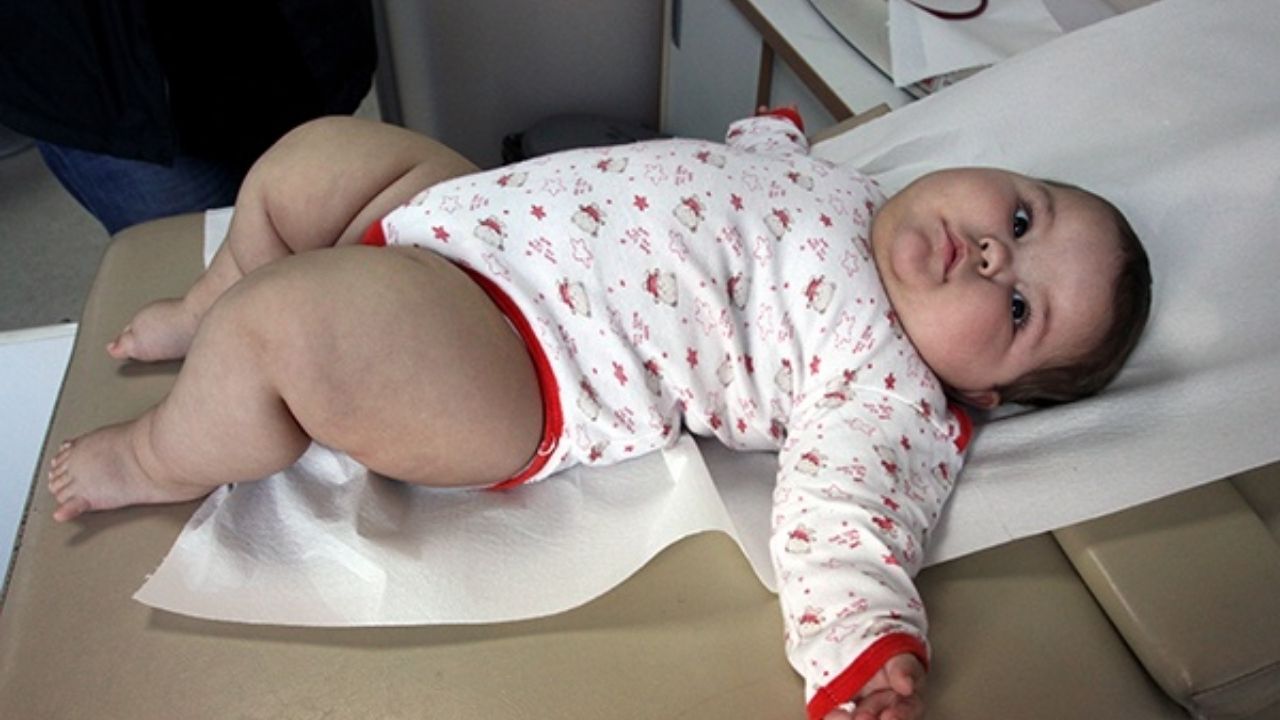 Şanlıurfa’da 11 aylık bebek 20 kiloyu geçti! 6