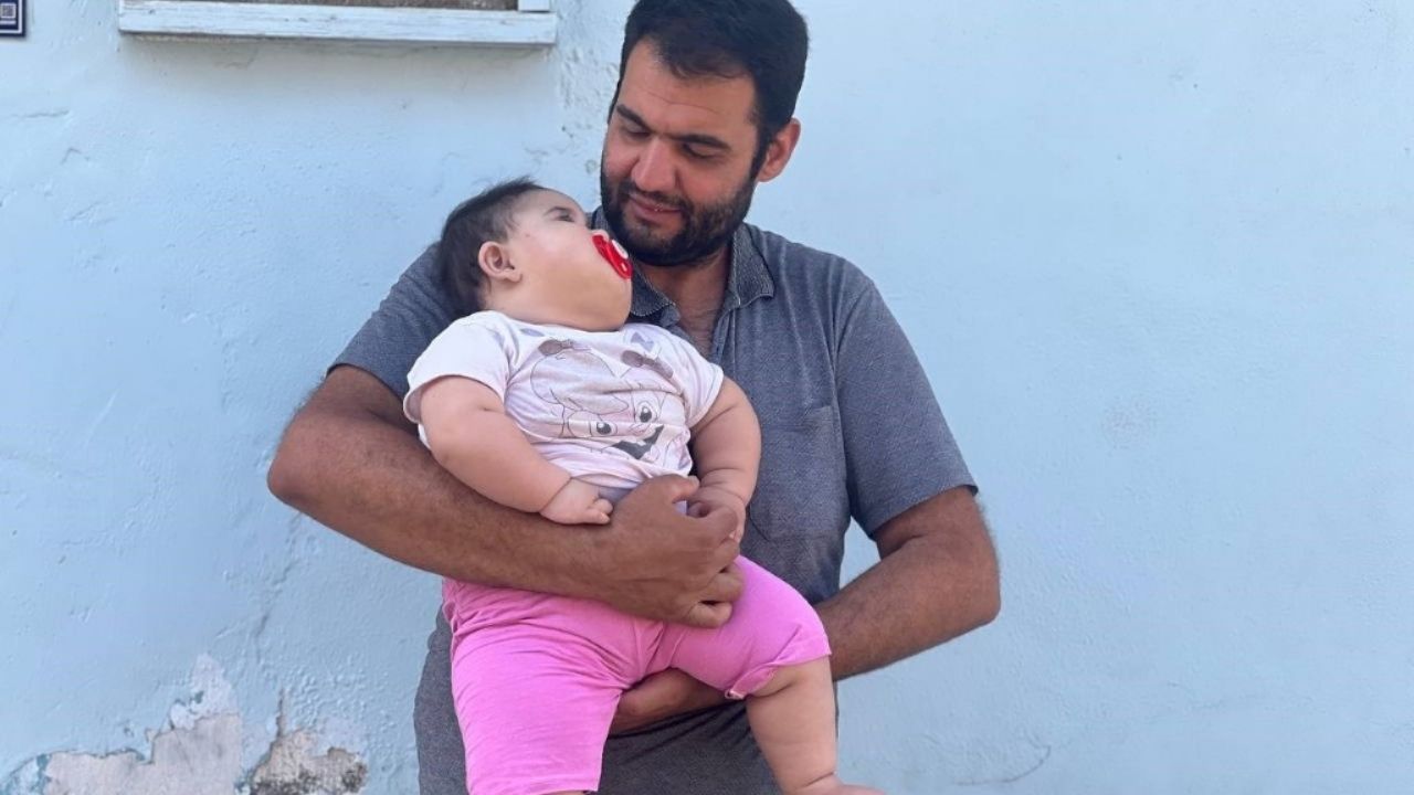 Şanlıurfa’da 11 aylık bebek 20 kiloyu geçti! 4